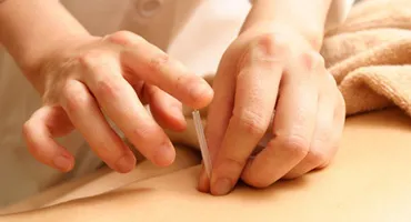 バイオリズムのドクター針